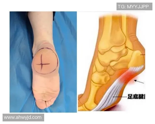 穿带铁钉的足球引发的运动安全隐患与解决方案探讨